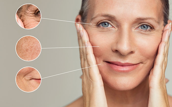 experience the transformative effects of Profhilo