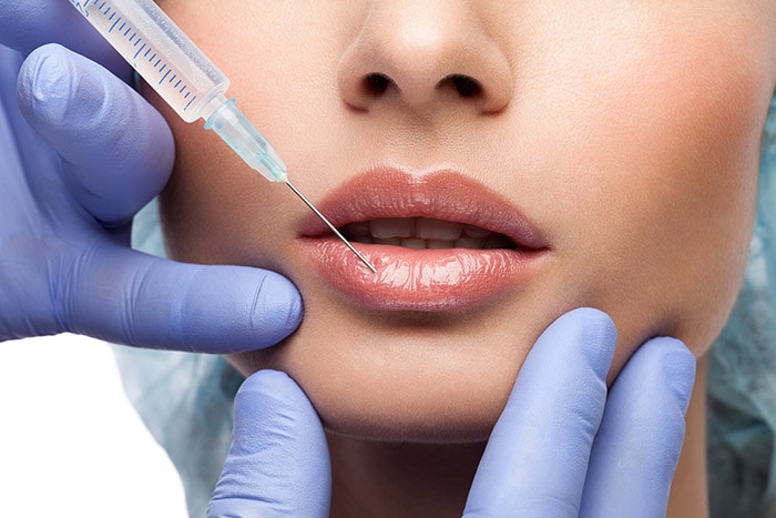 What are Dermal Fillers and How Do They Work?